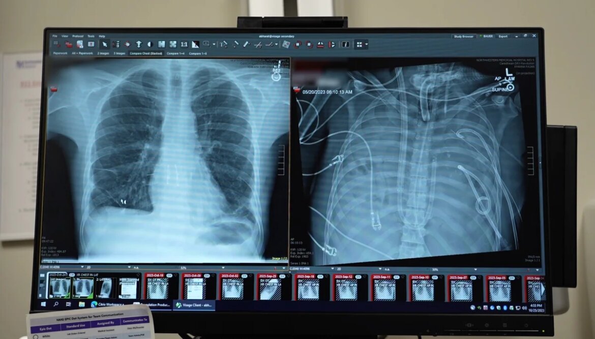 Doctors keep patients alive for two days using 'artificial lungs'

