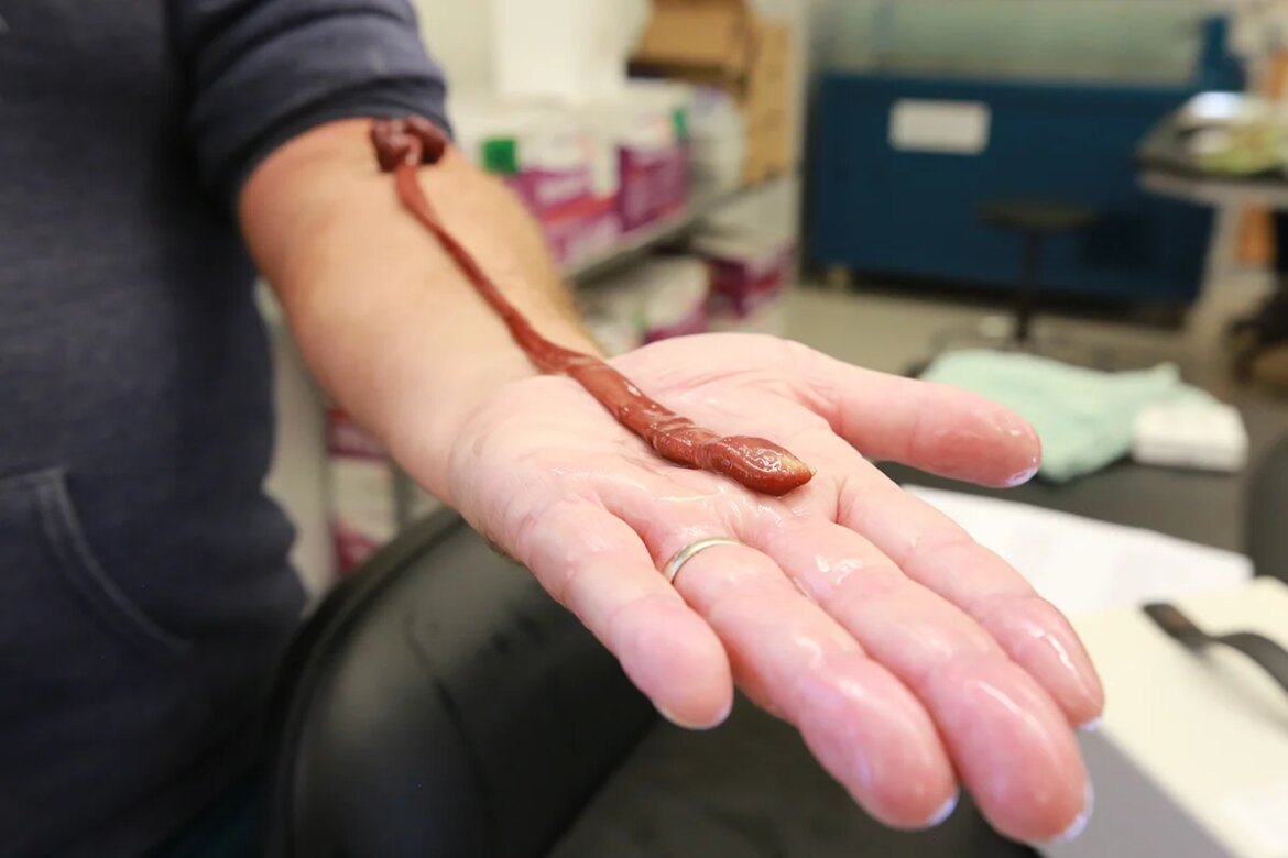 Meet 'Basodiscus the Eldest', a record-setting ribbon worm more than 27 years old

