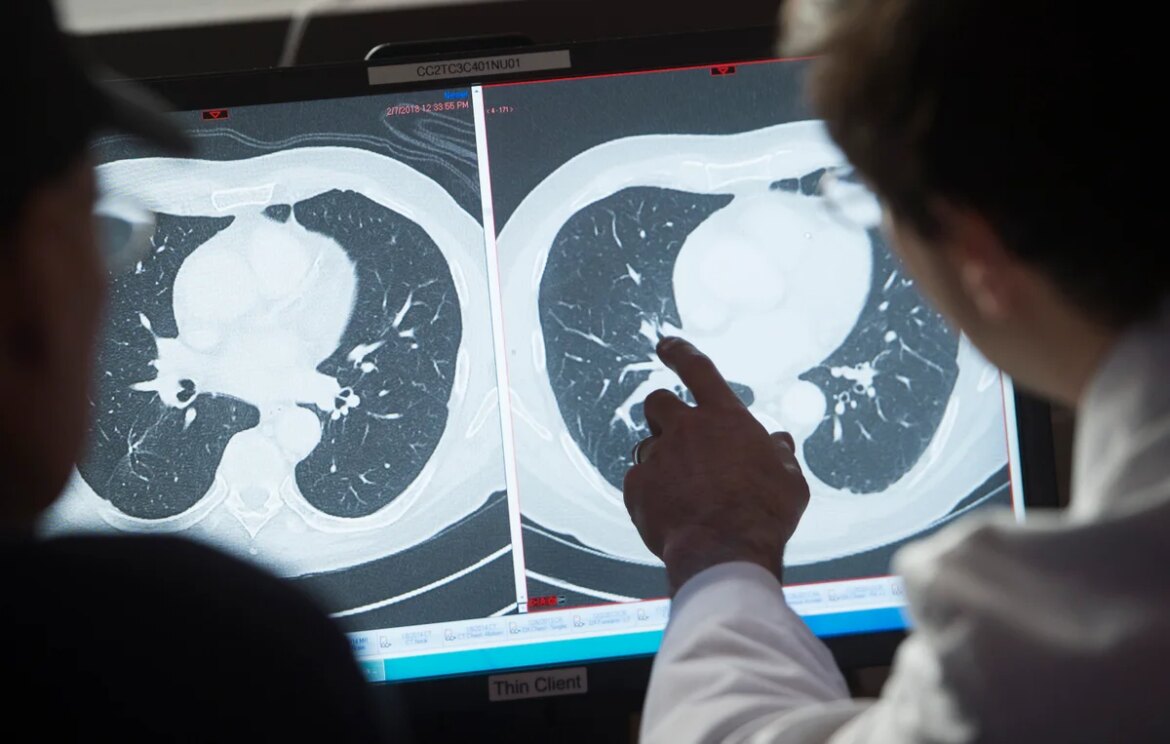 Study shows 70 percent of cancer patients now survive for at least five years

