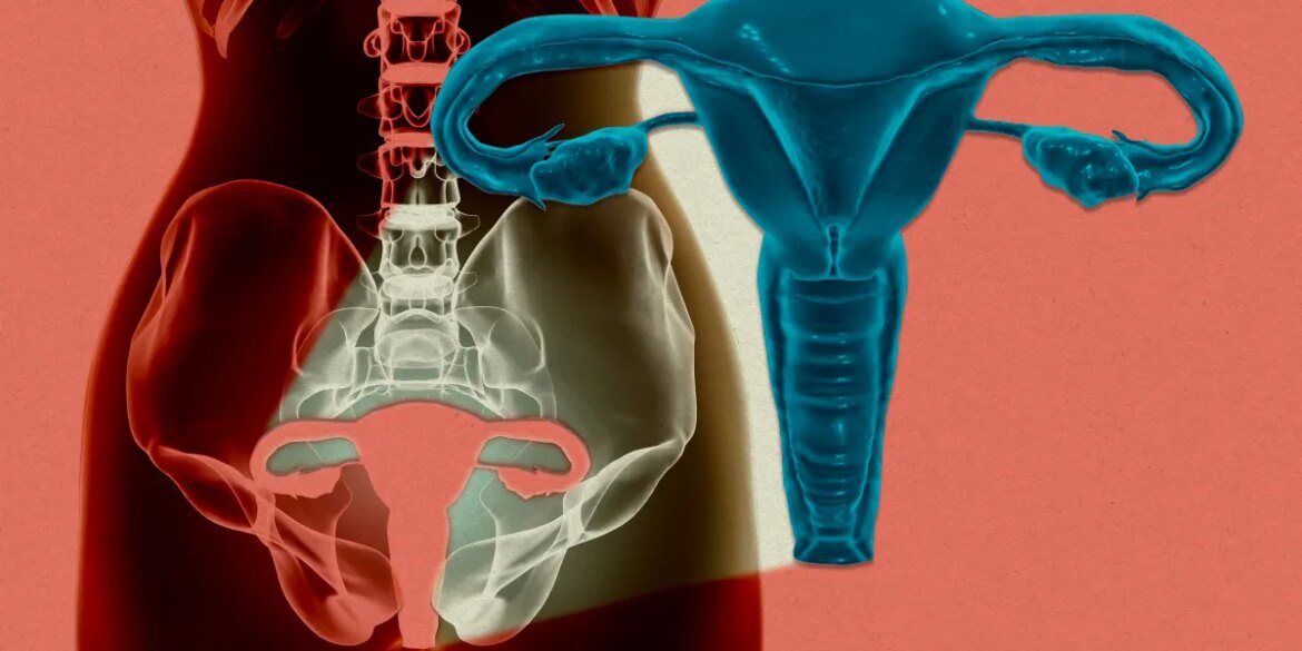 For the first time, a woman's uterus has been kept alive outside the body.

